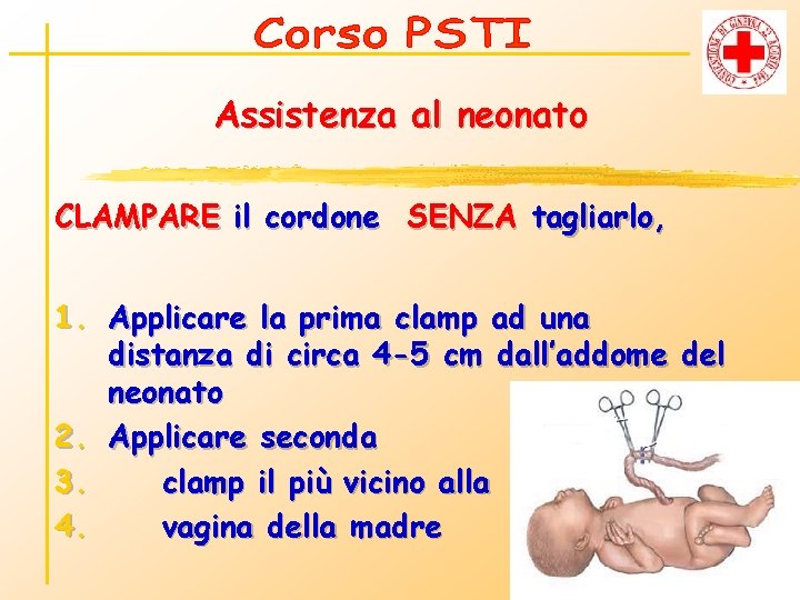 Assistenza al neonato CLAMPARE il cordone SENZA tagliarlo, 1. Applicare la prima clamp ad