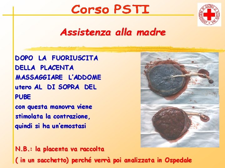 Assistenza alla madre DOPO LA FUORIUSCITA DELLA PLACENTA MASSAGGIARE L’ADDOME utero AL DI SOPRA