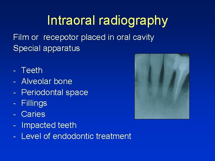 Intraoral radiography Film or recepotor placed in oral cavity Special apparatus - Teeth Alveolar