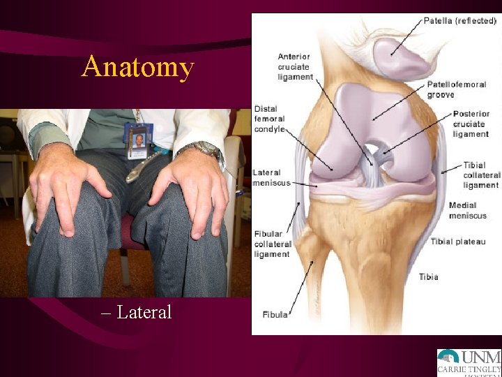 Anatomy • • • ACL PCL MCL LCL Meniscus – Medial – Lateral 