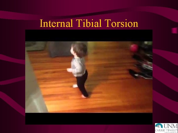 Internal Tibial Torsion 