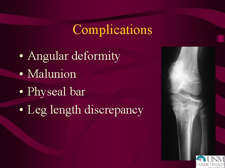 Complications • • Angular deformity Malunion Physeal bar Leg length discrepancy 