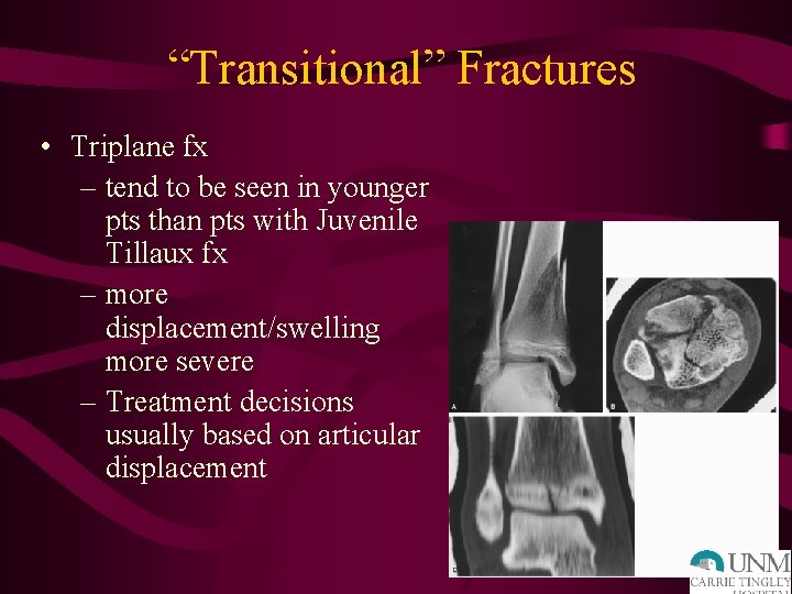 “Transitional” Fractures • Triplane fx – tend to be seen in younger pts than