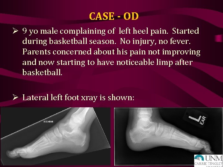 CASE - OD Ø 9 yo male complaining of left heel pain. Started during