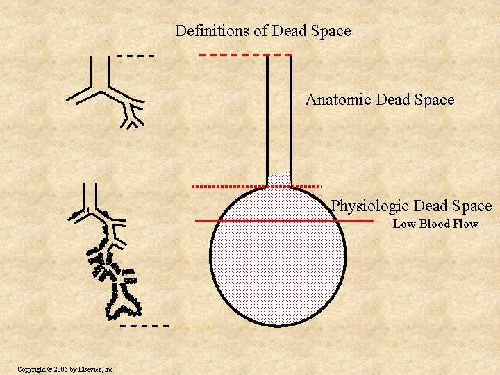 Definitions of Dead Space Anatomic Dead Space Physiologic Dead Space Low Blood Flow Copyright