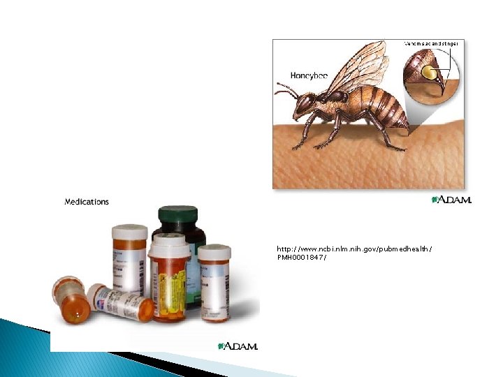 http: //www. ncbi. nlm. nih. gov/pubmedhealth/ PMH 0001847/ 