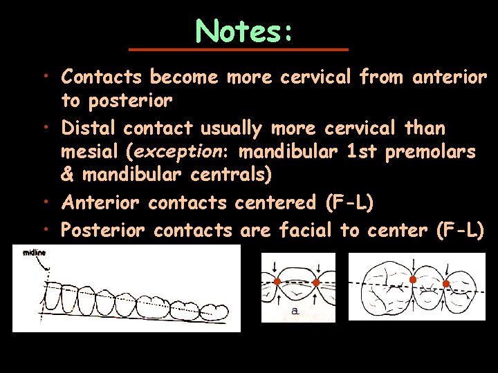 Notes: • Contacts become more cervical from anterior to posterior • Distal contact usually