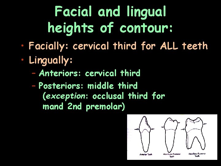 Facial and lingual heights of contour: • Facially: cervical third for ALL teeth •