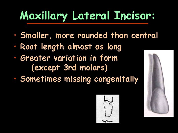 Maxillary Lateral Incisor: • Smaller, more rounded than central • Root length almost as