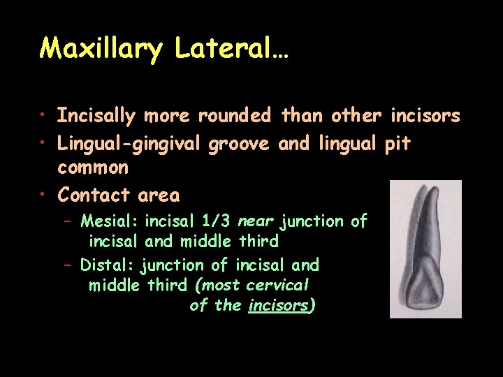 Maxillary Lateral… • Incisally more rounded than other incisors • Lingual-gingival groove and lingual