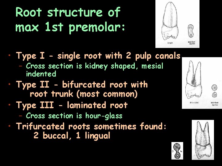 Root structure of max 1 st premolar: • Type I - single root with