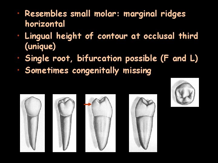  • Resembles small molar: marginal ridges horizontal • Lingual height of contour at