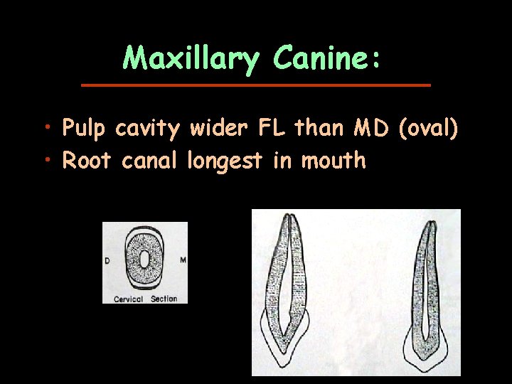 Maxillary Canine: • Pulp cavity wider FL than MD (oval) • Root canal longest