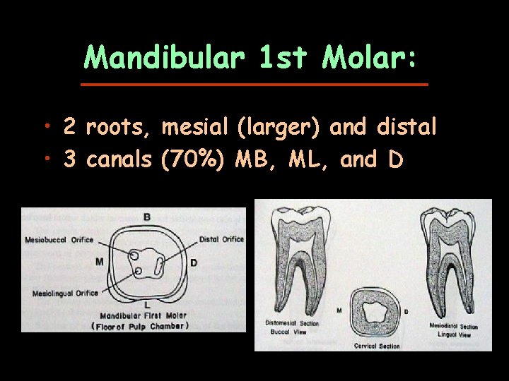 Mandibular 1 st Molar: • 2 roots, mesial (larger) and distal • 3 canals