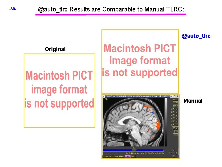 -30 - @auto_tlrc Results are Comparable to Manual TLRC: @auto_tlrc Original Manual 