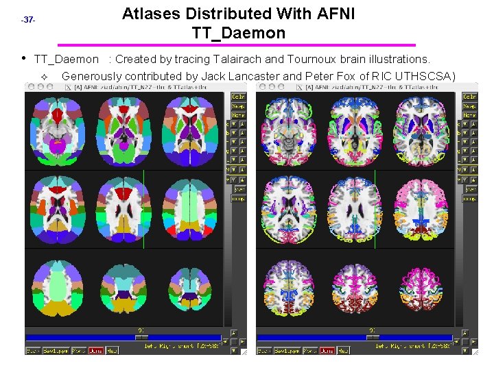 Atlases Distributed With AFNI TT_Daemon -37 - • TT_Daemon : Created by tracing Talairach