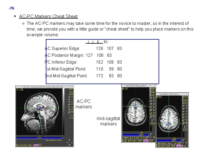 -70 - • AC-PC Markers Cheat Sheet The AC-PC markers may take some time