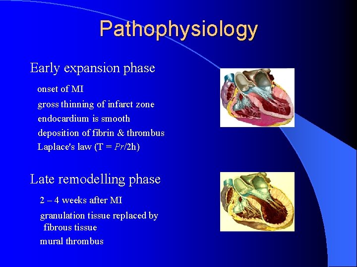 Pathophysiology Early expansion phase onset of MI gross thinning of infarct zone endocardium is