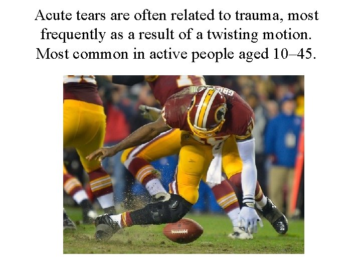 Acute tears are often related to trauma, most frequently as a result of a