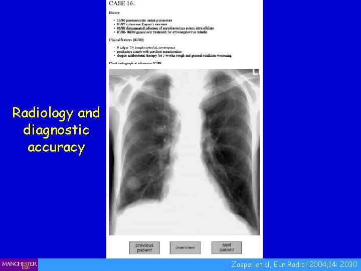Radiology and diagnostic accuracy Zaspel et al, Eur Radiol 2004; 14: 2030 