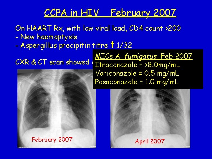 CCPA in HIV February 2007 On HAART Rx, with low viral load, CD 4