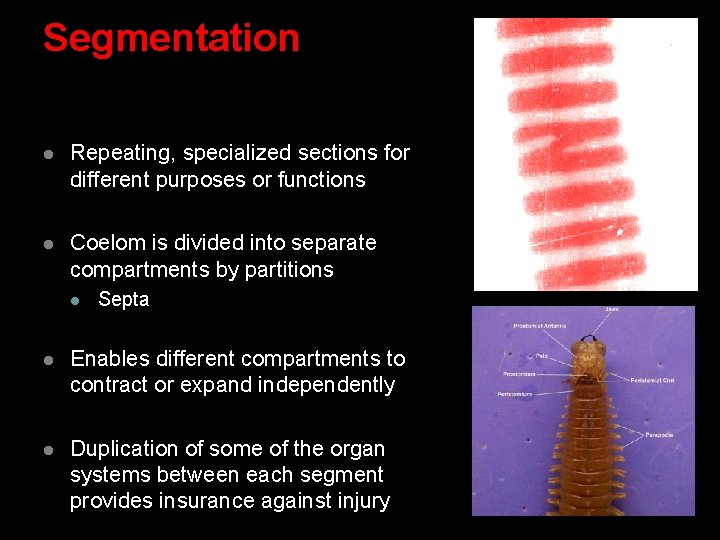 Segmentation l Repeating, specialized sections for different purposes or functions l Coelom is divided Segmentation l Repeating, specialized sections for different purposes or functions l Coelom is divided