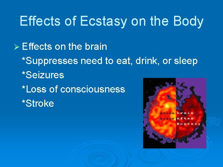 Effects of Ecstasy on the Body Ø Effects on the brain *Suppresses need to