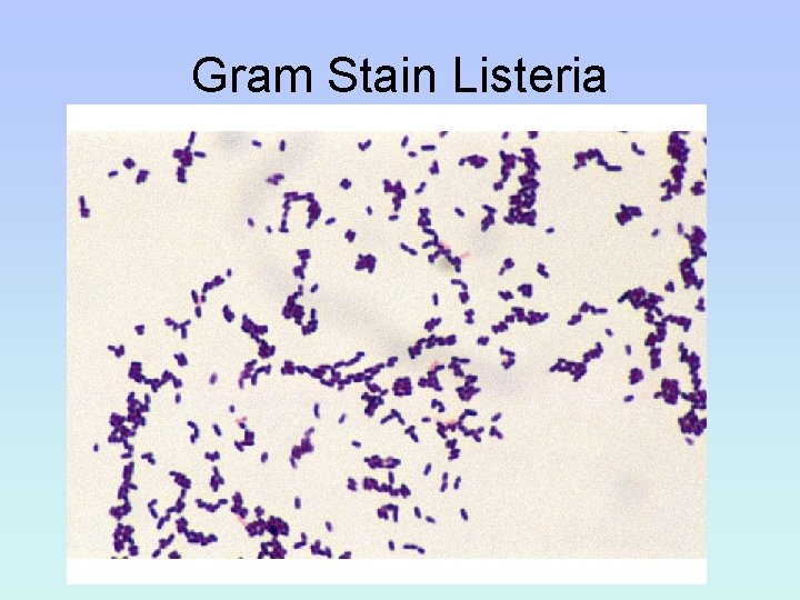 Gram Stain Listeria 