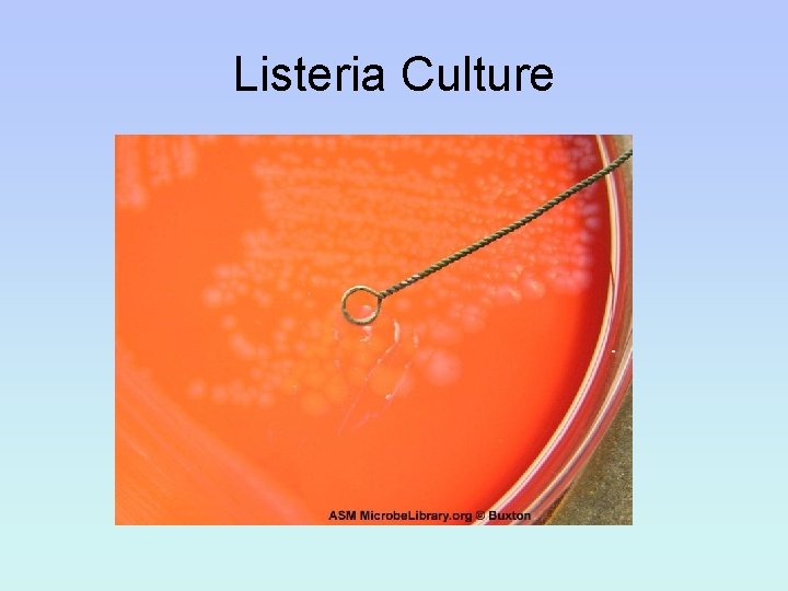 Listeria Culture 