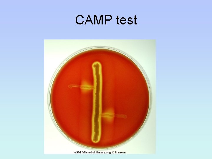 CAMP test 