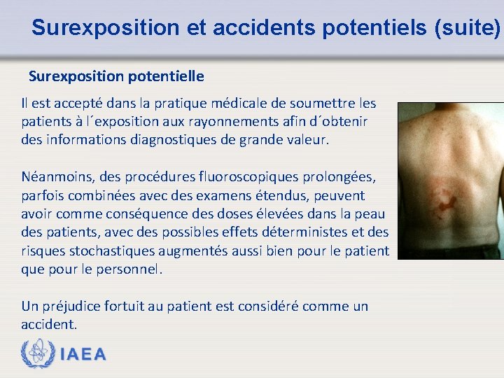 Surexposition et accidents potentiels (suite) Surexposition potentielle Il est accepté dans la pratique médicale