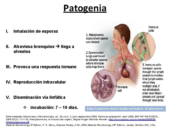 Patogenia I. Inhalación de esporas II. Atraviesa bronquios llega a alveolos III. Provoca una