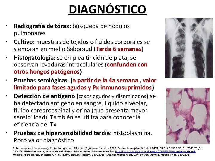 DIAGNÓSTICO Radiografía de tórax: búsqueda de nódulos pulmonares Cultivo: muestras de tejidos o fluidos