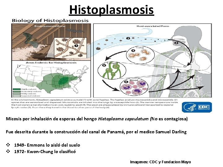 Histoplasmosis Micosis por inhalación de esporas del hongo Histoplasma capsulatum (No es contagiosa) Fue