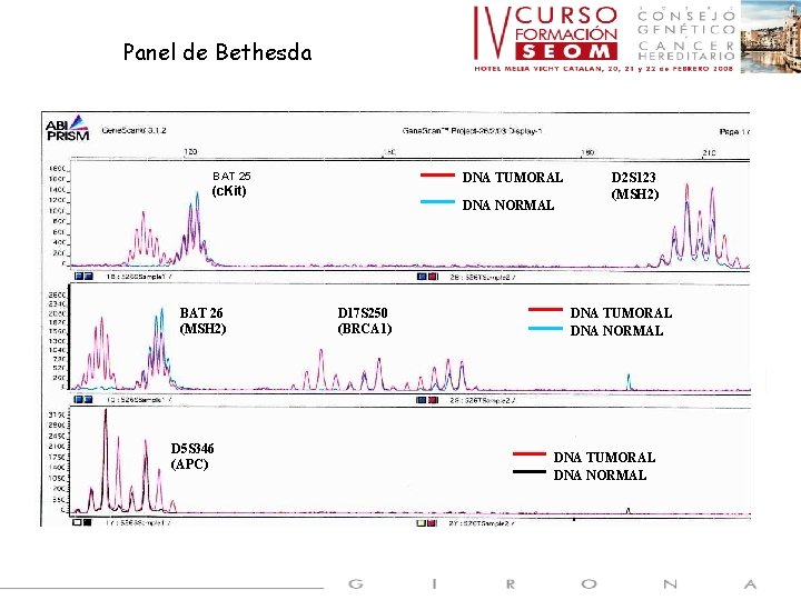 Panel de Bethesda BAT 25 DNA TUMORAL (c. Kit) BAT 26 (MSH 2) D