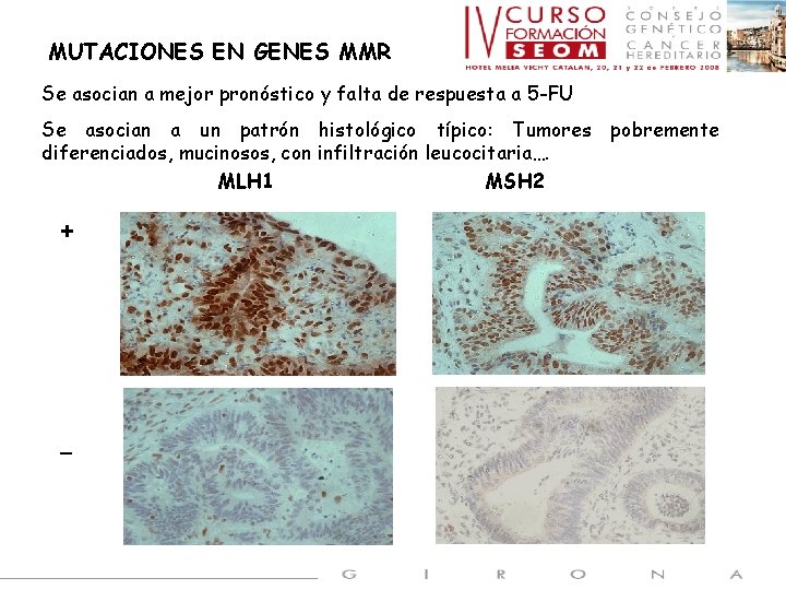 MUTACIONES EN GENES MMR Se asocian a mejor pronóstico y falta de respuesta a