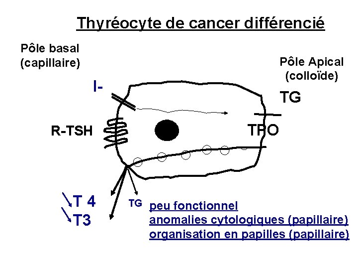 Thyréocyte de cancer différencié Pôle basal (capillaire) Pôle Apical (colloïde) I- TG TPO R-TSH