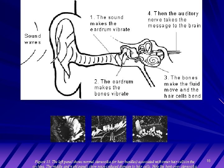 Figure 15. The left panel shows normal stereocilia (or hair bundles) associated with inner