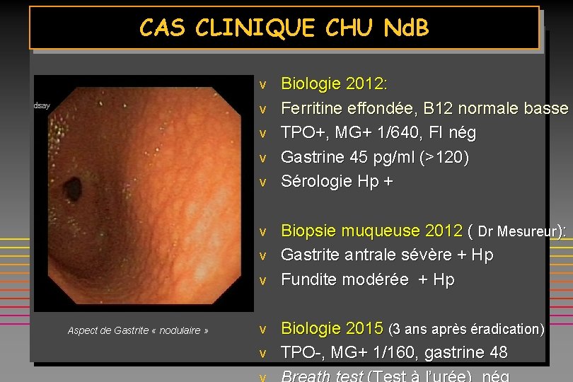 CAS CLINIQUE CHU Nd. B v v v Biologie 2012: Ferritine effondée, B 12