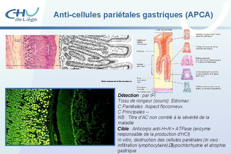 Anti-cellules pariétales gastriques (APCA) Photos données par la firme Euroimmun Détection : par IFI