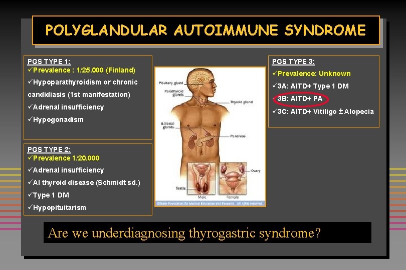 POLYGLANDULAR AUTOIMMUNE SYNDROME PGS TYPE 1: üPrevalence : 1/25. 000 (Finland) üHypoparathyroidism or chronic