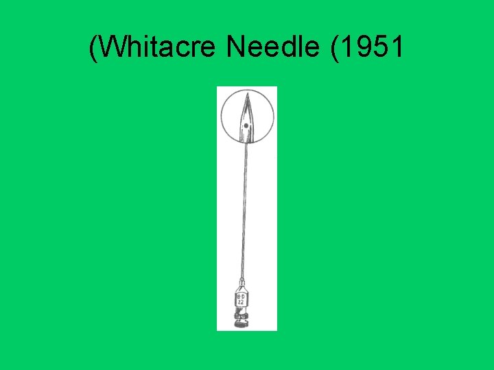 (Whitacre Needle (1951 