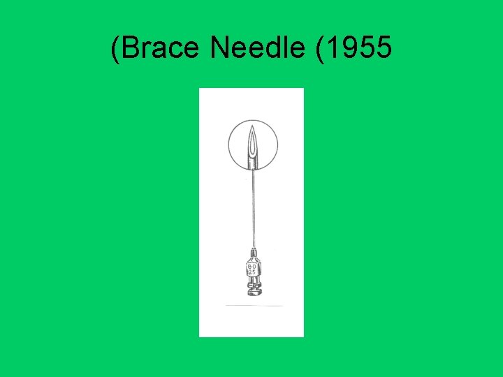 (Brace Needle (1955 