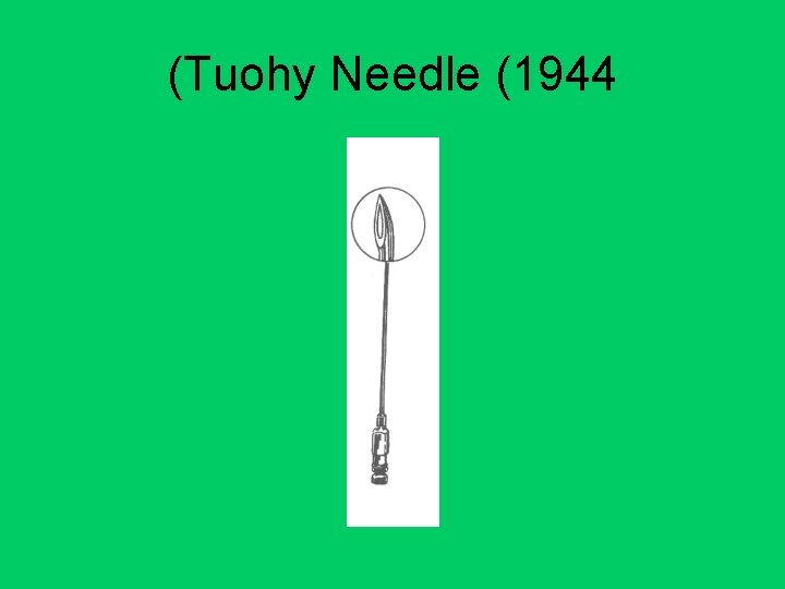 (Tuohy Needle (1944 
