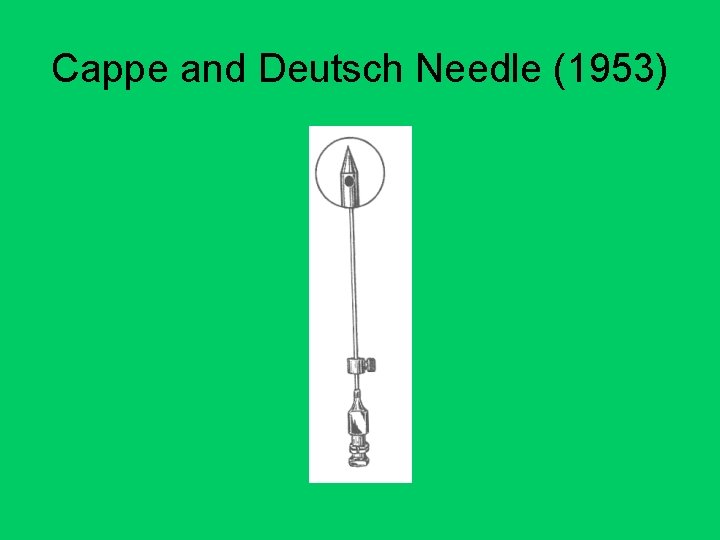Cappe and Deutsch Needle (1953) 