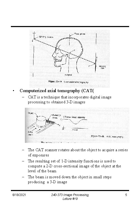  • Computerized axial tomography (CAT( – CAT is a technique that incorporates digital