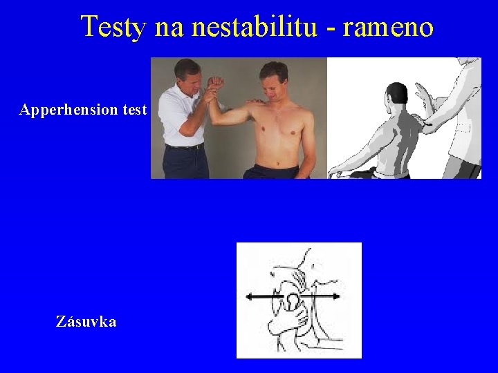 Testy na nestabilitu - rameno Apperhension test Zásuvka 