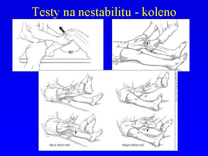 Testy na nestabilitu - koleno 