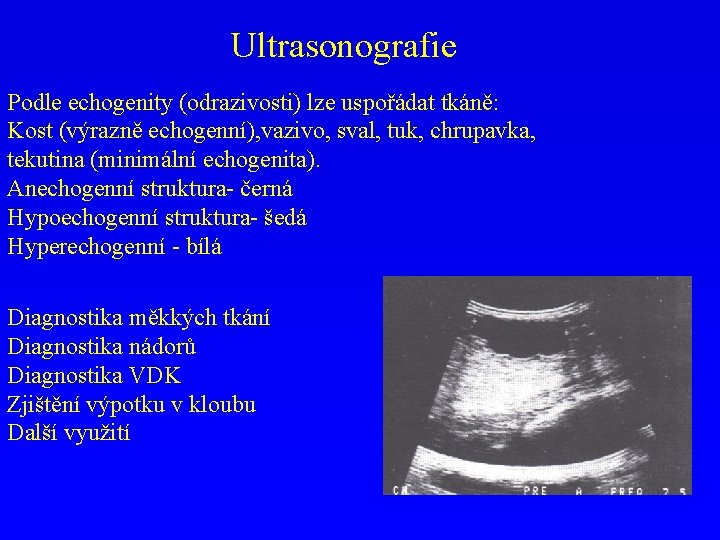 Ultrasonografie Podle echogenity (odrazivosti) lze uspořádat tkáně: Kost (výrazně echogenní), vazivo, sval, tuk, chrupavka,