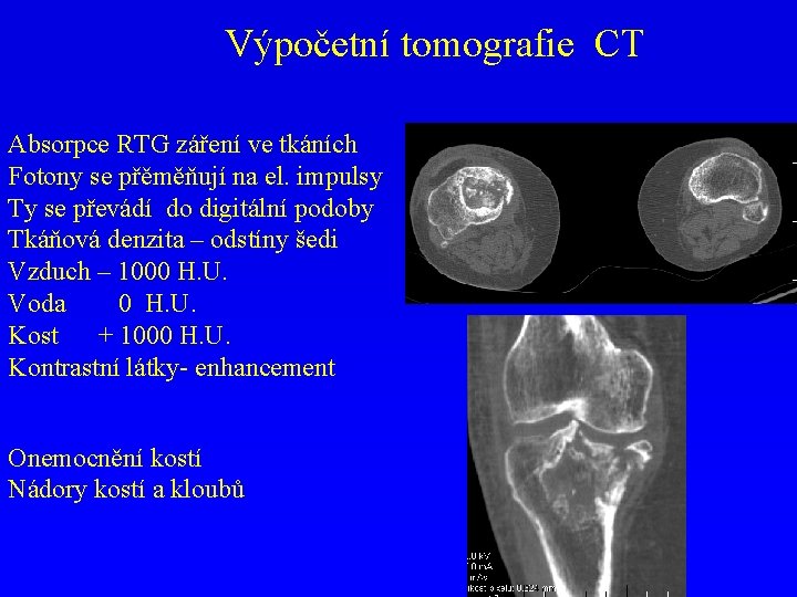 Výpočetní tomografie CT Absorpce RTG záření ve tkáních Fotony se přěměňují na el. impulsy